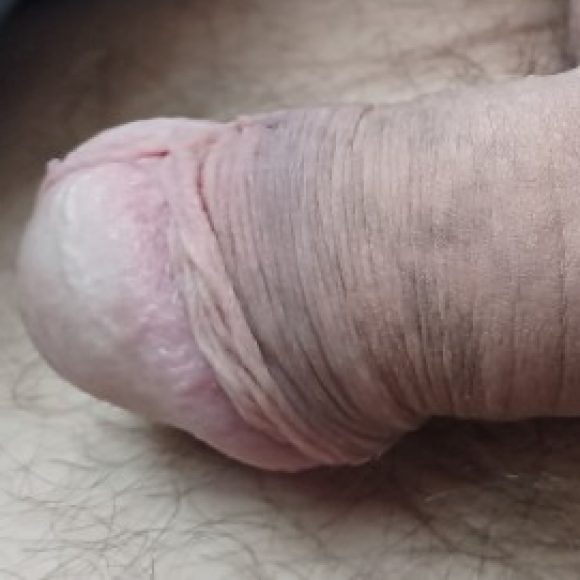 Profilbillede af Gismoo